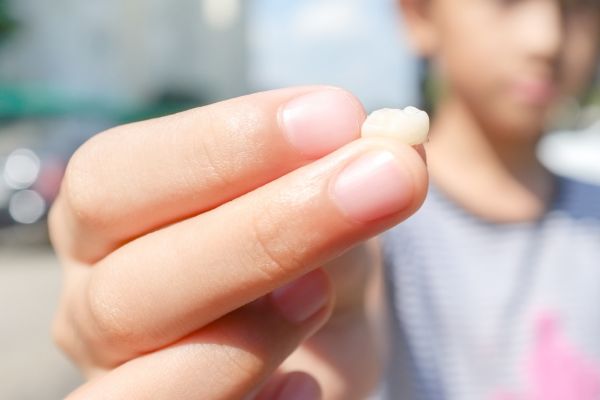 Milk Tooth