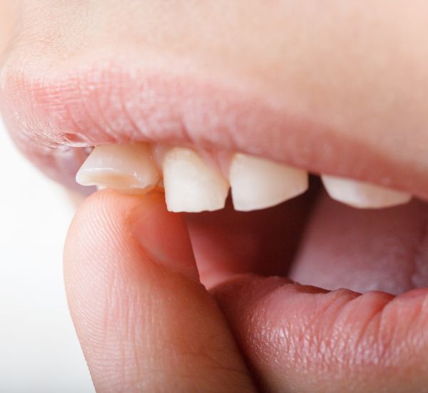 Loose Baby Teeth
